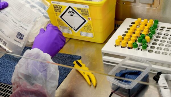 Apparition de cas de variole du singe : la Russie accuse les États-Unis