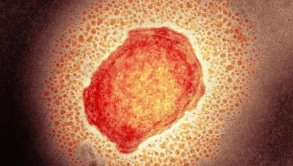 États-Unis : une urgence sanitaire déclarée en raison de l&rsquo;épidémie de la variole du singe
