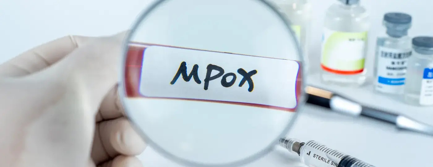 Mpox : Une nouvelle alerte sanitaire en France, faut-il s’inquiéter ?