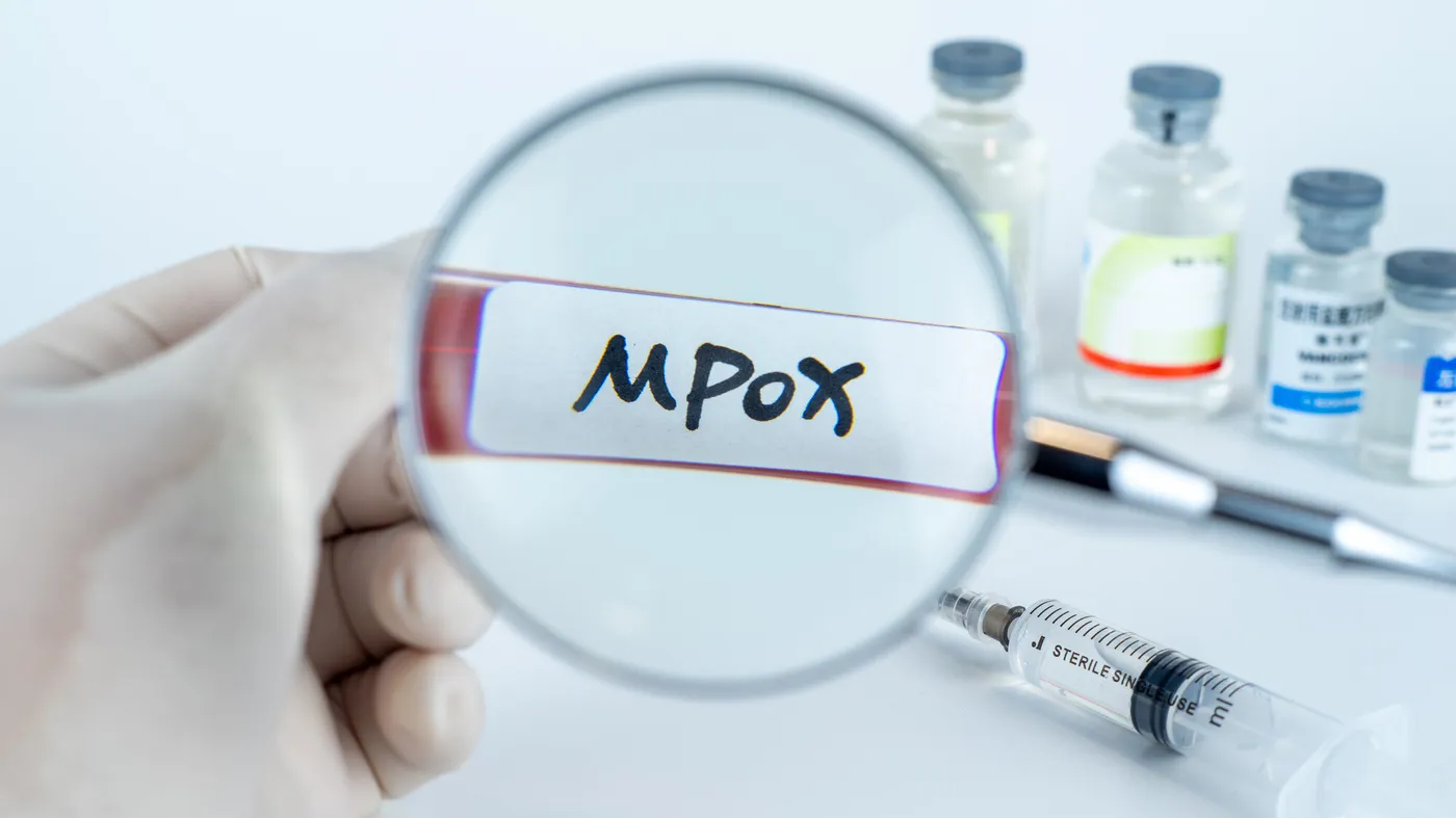 Mpox : Une nouvelle alerte sanitaire en France, faut-il s’inquiéter ?